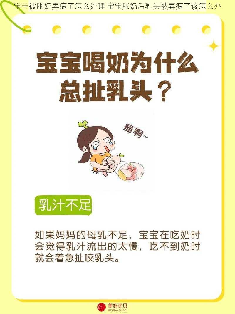 宝宝被胀奶弄瘪了怎么处理 宝宝胀奶后乳头被弄瘪了该怎么办